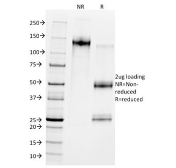 MDM2 Antibody