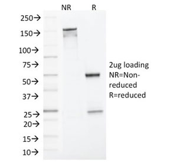 MLH1 Antibody / MutL protein homolog 1