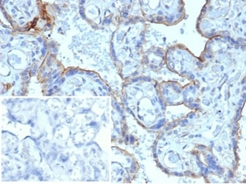 MMP3 Antibody / Matrix Metalloproteinase 3
