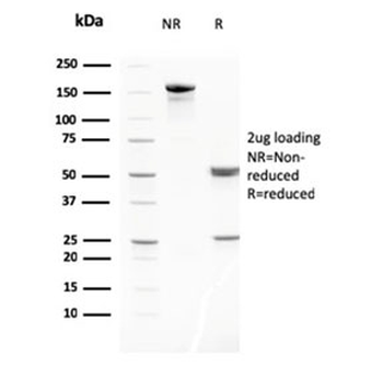 MMP3 Antibody / Matrix Metalloproteinase 3