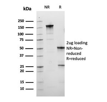 Calbindin Antibody / CALB1