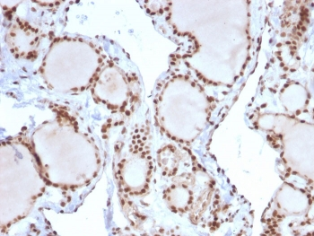 MSH2 Antibody