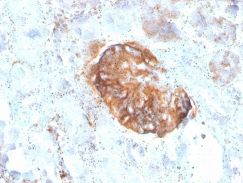 MTAP Antibody