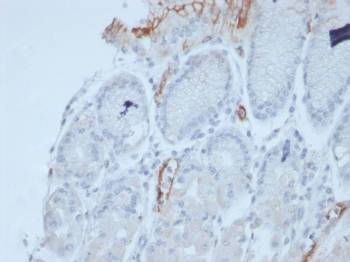 Recombinant MUC2 Antibody / Mucin 2