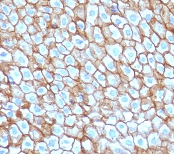 DSG3 Antibody / Desmoglein 3