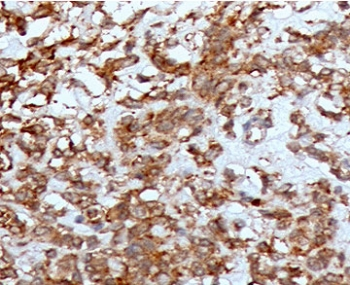 CTSK Antibody / Cathepsin K