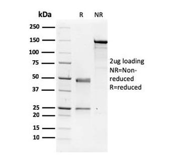 NME1 Antibody / NM23