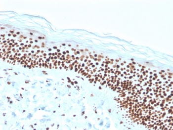 Recombinant Nucleophosmin Antibody / NPM1