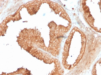 Recombinant ODC1 Antibody / Ornithine Decarboxylase
