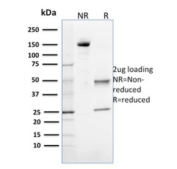 OGG1 Antibody / 8-Oxoguanine DNA Glycosylase