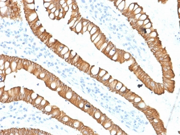 Cytokeratin 20 Antibody / CK20