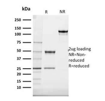 Cytokeratin 20 Antibody / CK20