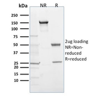 EGLN1 Antibody / PHD2