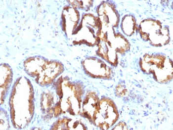 PSAP Antibody / Prostate Specific Acid Phosphatase