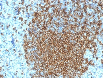 CD45RA Antibody (Leukocyte marker)