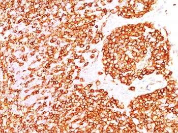 CD45 Antibody (Leukocyte marker)