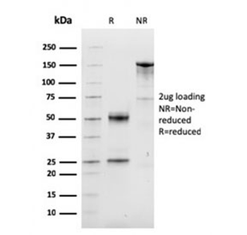 Cyclin D1 Antibody / CCND1