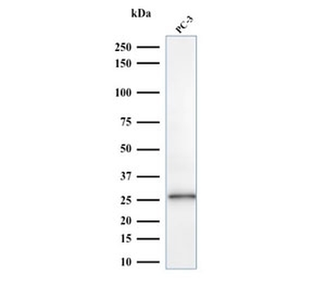 C1QA Antibody / Complement C1q A-Chain