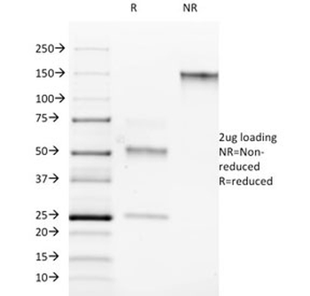 RORC Antibody
