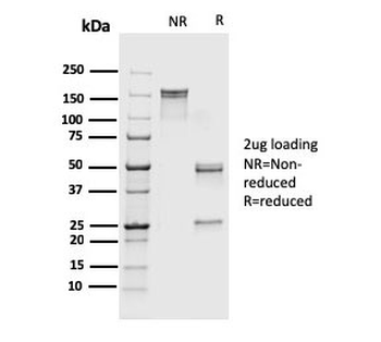 Recombinant FSP1 Antibody / S100A4