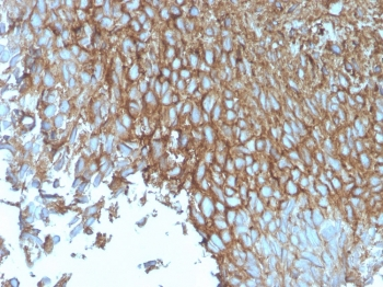 Recombinant GLUT1 Antibody / SLC2A1