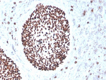 Recombinant SOX2 Antibody