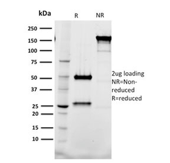 TAL1 Antibody / T-cell acute lymphocytic leukemia protein 1