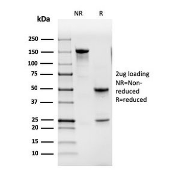 Granulocyte-Macrophage CSF Antibody / CSF2