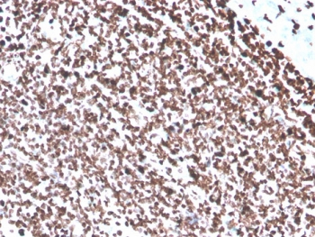 Recombinant dsDNA Antibody