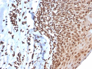 Recombinant dsDNA Antibody
