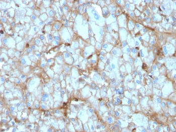 C1QA Antibody / Complement C1q A-Chain