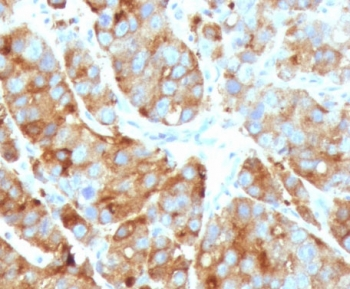 Cytokeratin 15 Antibody / KRT15