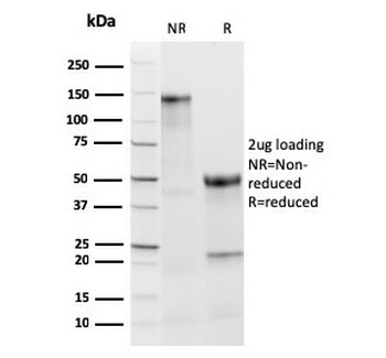 Recombinant Thyroid Peroxidase Antibody