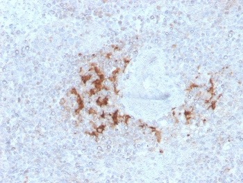 TRAF1 Antibody