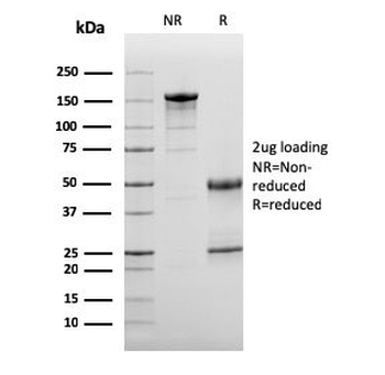Complement 3d Antibody / C3d