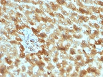 Complement 3d Antibody / C3d