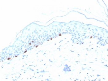 Tyrosinase-Related Protein-1 Antibody / TRP1 / TYRP1