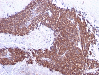 TOP1MT Antibody / Topoisomerase I mitochondrial