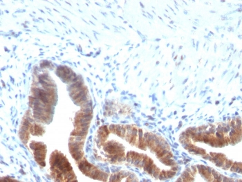 TOP1MT Antibody / Topoisomerase I mitochondrial