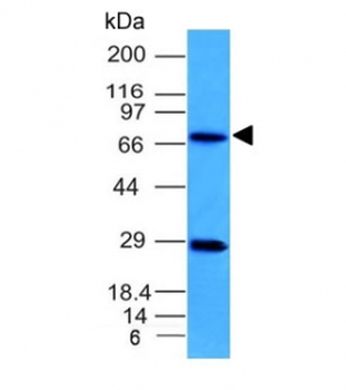 TOP1MT Antibody / Topoisomerase I mitochondrial