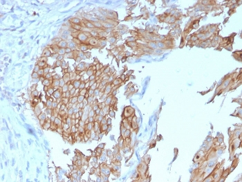 UPK1B Antibody / Uroplakin 1B