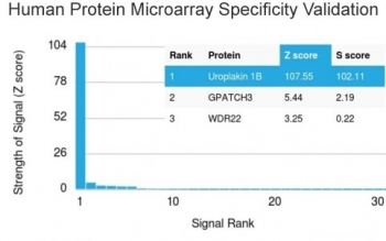 UPK1B Antibody / Uroplakin 1B