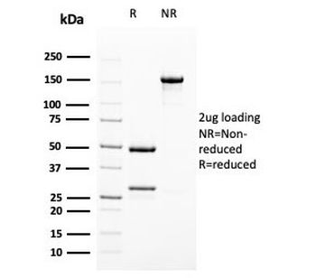 UPK1B Antibody / Uroplakin 1B