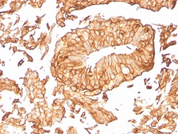 Uroplakin 1B Antibody / UPK1B