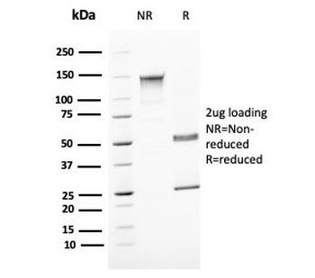 Uroplakin 1B Antibody / UPK1B