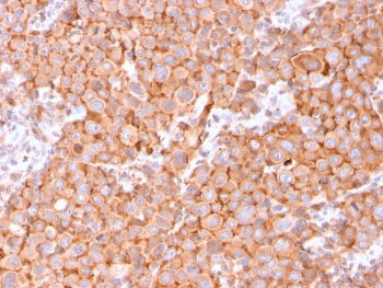 UPK1B Antibody / Uroplakin 1B