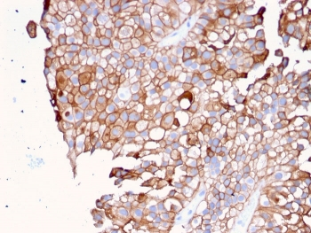 UPK1B Antibody / Uroplakin 1B