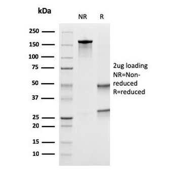 Uroplakin 1B Antibody / UPK1B
