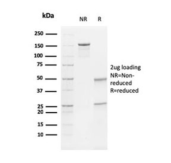 Vimentin Antibody
