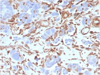 Vimentin Antibody
